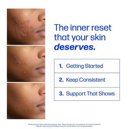Clear³  Skin Support